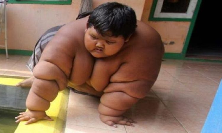 Lembra dele? Veja como está o menino 'mais gordo do mundo' após perder 110kg  - Diario ao Vivo